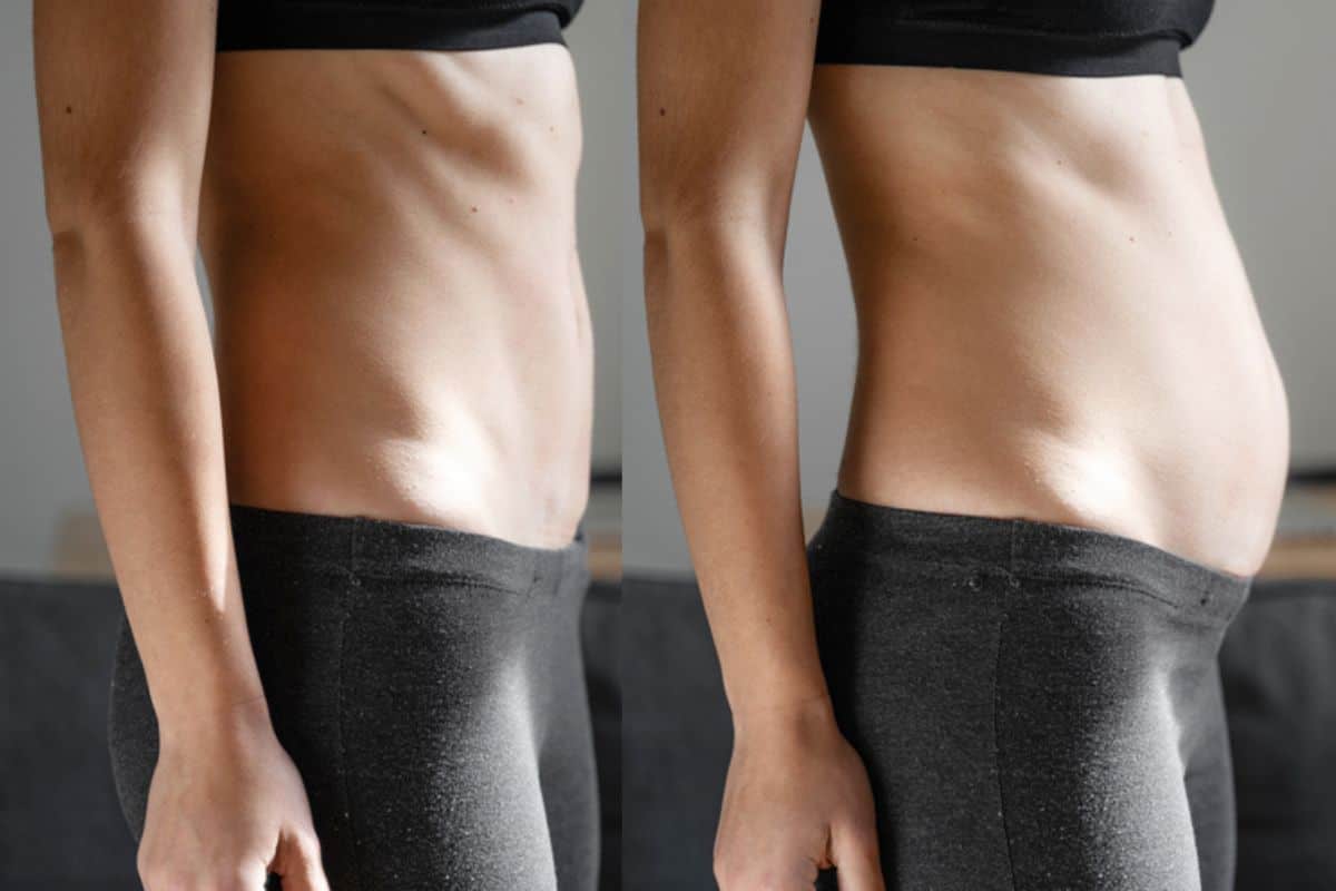 How long does diastasis recti take to improve Cirencester?