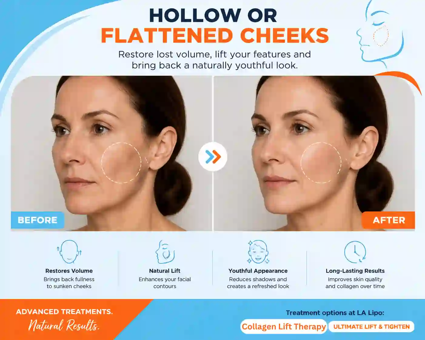 Sign #4: Hollow or Flattened Cheeks Cirencester