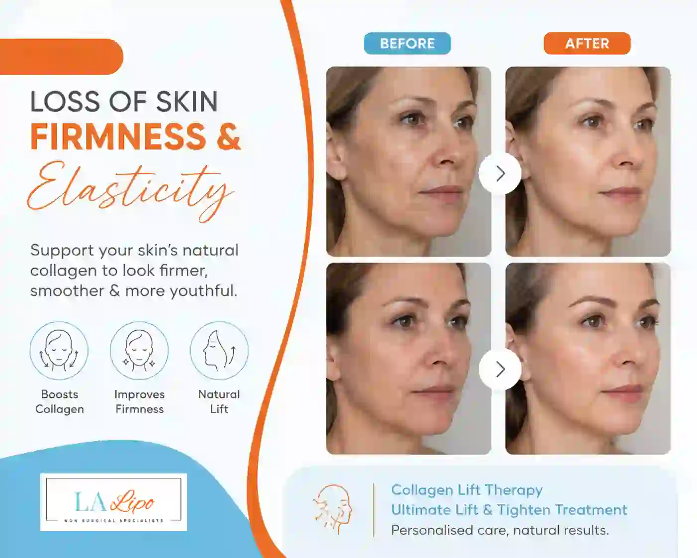 Sign #7: Loss of Skin Firmness and Elasticity Cirencester